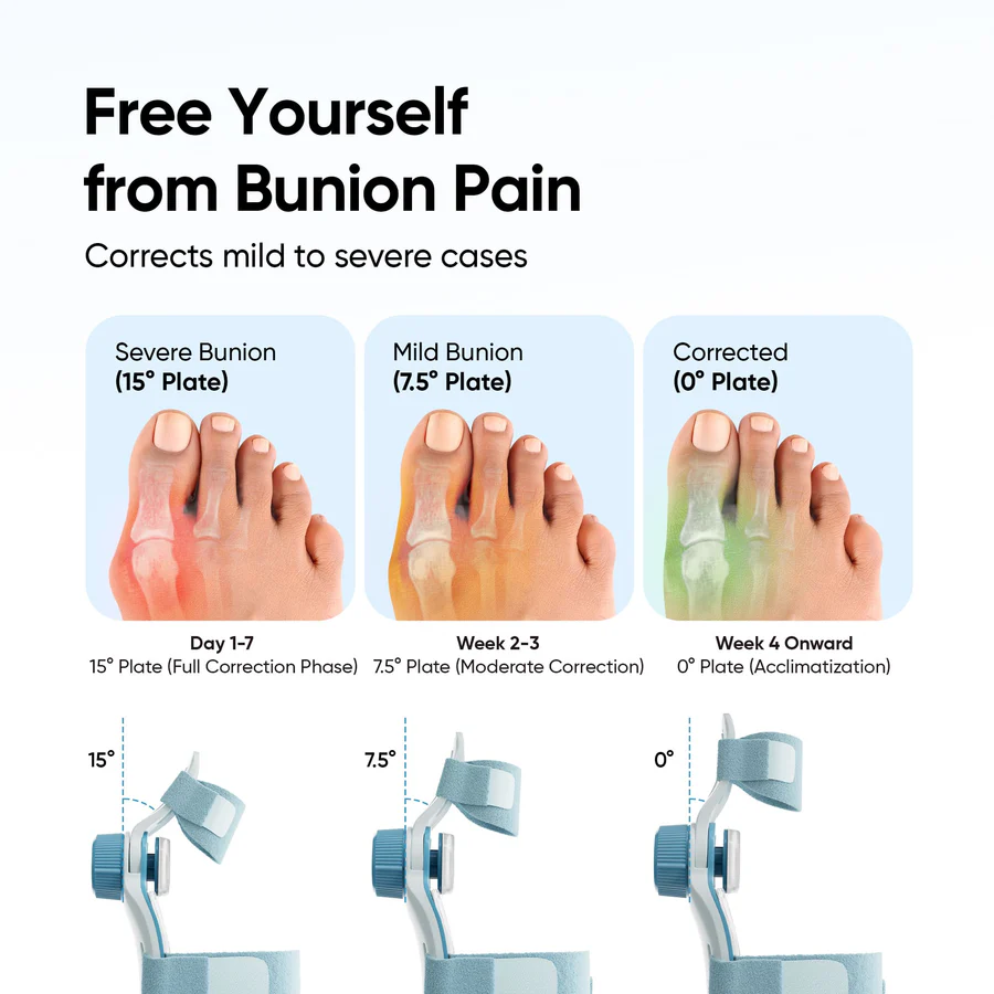 Frido Orthotics Bunion Corrector - Image 5